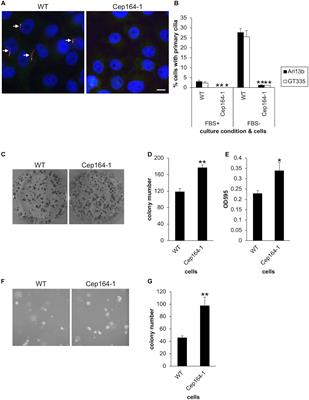 CEP164 Deficiency Causes Hyperproliferation of Pancreatic Cancer Cells